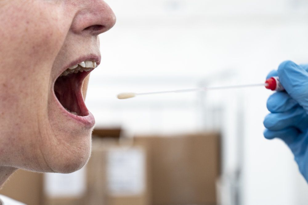 De lange ventetider på coronatest skal undgåes ved at åbne muligheden for